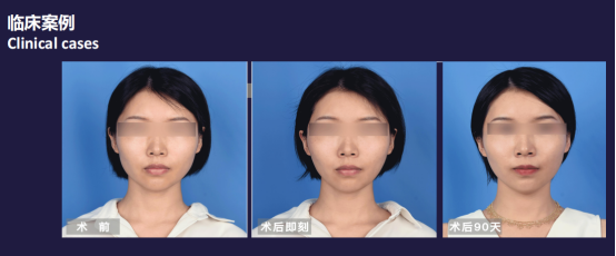 1640852655740868.png image.png